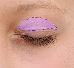Upper eyelid blepharoplasty marking